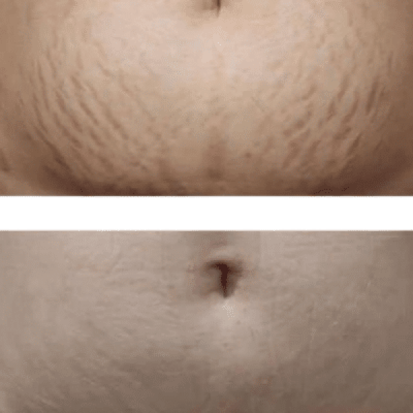 Untitled design (11)